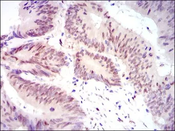 Anti-YAP1 antibody [1A12] used in IHC (Paraffin sections) (IHC-P). GTX60554