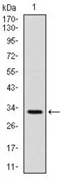Anti-CD30 antibody [3B10] used in Western Blot (WB). GTX60555