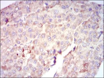 Anti-Raf1 antibody [4G4] used in IHC (Paraffin sections) (IHC-P). GTX60556