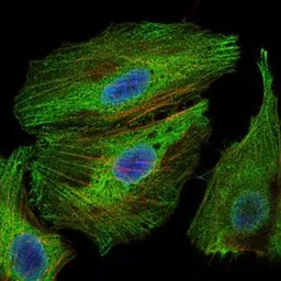 Anti-PBK antibody [2C8] used in Immunocytochemistry/ Immunofluorescence (ICC/IF). GTX60560