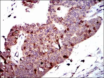 Anti-PBK antibody [2C8] used in IHC (Paraffin sections) (IHC-P). GTX60560