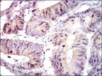 Anti-PBK antibody [2C8] used in IHC (Paraffin sections) (IHC-P). GTX60560