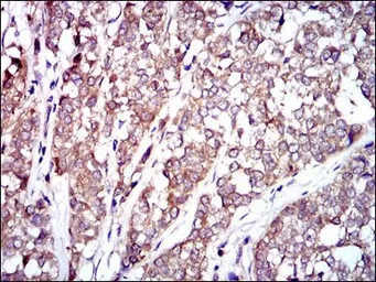 Anti-Raf1 antibody [4G4] used in IHC (Paraffin sections) (IHC-P). GTX60561