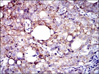 Anti-Integrin beta 1 / CD29 antibody [3B6] used in IHC (Paraffin sections) (IHC-P). GTX60563