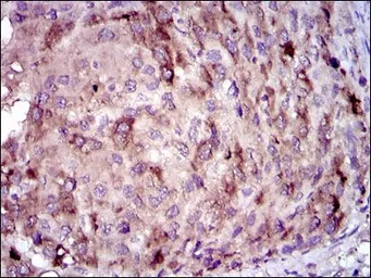 Anti-C Reactive Protein antibody [1G1] used in IHC (Paraffin sections) (IHC-P). GTX60566
