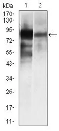 Anti-Alkaline Phosphatase (Tissue Non-Specific) antibody [2F4] used in Western Blot (WB). GTX60568
