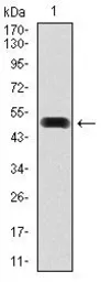 Anti-Fibronectin antibody [2F4G2] used in Western Blot (WB). GTX60571