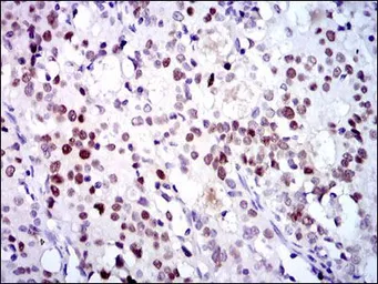 Anti-CDK2 antibody [1A6] used in IHC (Paraffin sections) (IHC-P). GTX60572