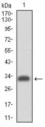 Anti-Integrin alpha 4 antibody [5C4] used in Western Blot (WB). GTX60576