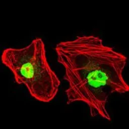 Anti-RPA70 antibody [4C4] used in Immunocytochemistry/ Immunofluorescence (ICC/IF). GTX60579