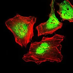 Anti-Cytokeratin 5 antibody [2C2] used in Immunocytochemistry/ Immunofluorescence (ICC/IF). GTX60580