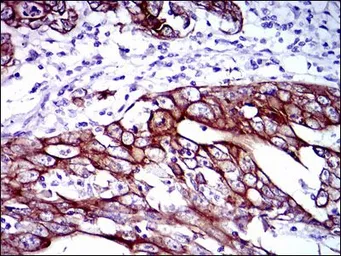 Anti-Cytokeratin 5 antibody [2C2] used in IHC (Paraffin sections) (IHC-P). GTX60580