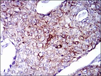Anti-Cytokeratin 5 antibody [2C2] used in IHC (Paraffin sections) (IHC-P). GTX60580