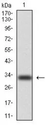 Anti-Cytokeratin 5 antibody [2C2] used in Western Blot (WB). GTX60580
