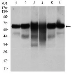 Anti-Cytokeratin 5 antibody [2C2] used in Western Blot (WB). GTX60580