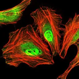 Anti-C/EBP alpha antibody [5B7] used in Immunocytochemistry/ Immunofluorescence (ICC/IF). GTX60584