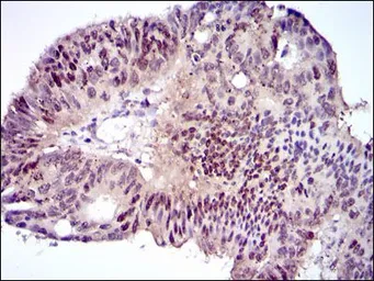 Anti-C/EBP alpha antibody [5B7] used in IHC (Paraffin sections) (IHC-P). GTX60584