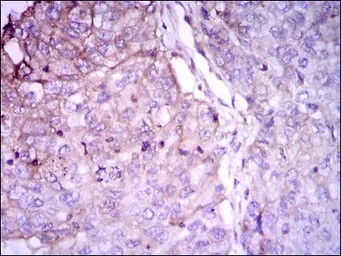 Anti-RAB4A antibody [4E11] used in IHC (Paraffin sections) (IHC-P). GTX60601