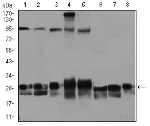 Anti-RAB4A antibody [4E11] used in Western Blot (WB). GTX60601