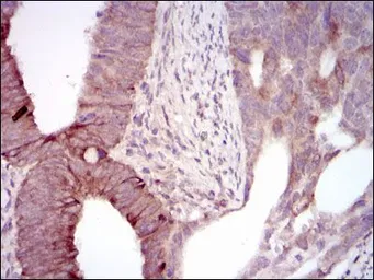 Anti-MELK antibody [2G2] used in IHC (Paraffin sections) (IHC-P). GTX60605