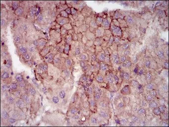 Anti-MELK antibody [2G2] used in IHC (Paraffin sections) (IHC-P). GTX60605