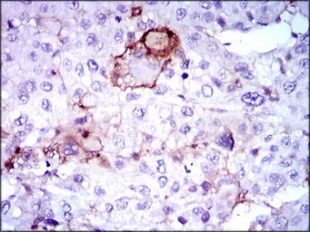 Anti-LPA antibody [4H1] used in IHC (Paraffin sections) (IHC-P). GTX60611