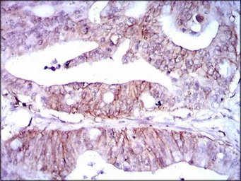 Anti-LPA antibody [4H1] used in IHC (Paraffin sections) (IHC-P). GTX60611