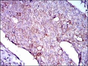Anti-LPA antibody [4H1] used in IHC (Paraffin sections) (IHC-P). GTX60611
