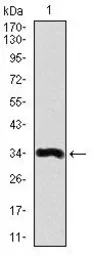 Anti-LPA antibody [4H1] used in Western Blot (WB). GTX60611