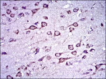 Anti-Doublecortin antibody [2G5] used in IHC (Paraffin sections) (IHC-P). GTX60612