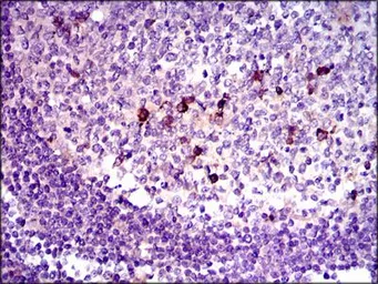 Anti-TGF beta 1 antibody [7F6] used in IHC (Paraffin sections) (IHC-P). GTX60614