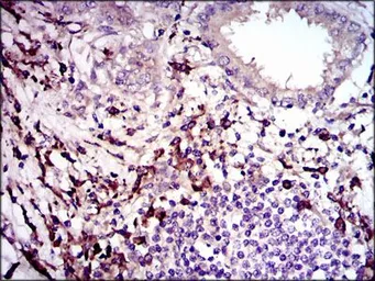 Anti-TGF beta 1 antibody [7F6] used in IHC (Paraffin sections) (IHC-P). GTX60614