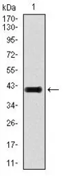 Anti-TGF beta 1 antibody [7F6] used in Western Blot (WB). GTX60614