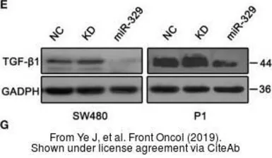 Anti-TGF beta 1 antibody [7F6] used in Western Blot (WB). GTX60614