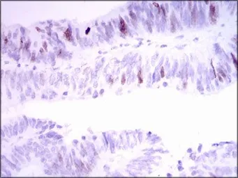 Anti-INCENP antibody [3D2] used in IHC (Paraffin sections) (IHC-P). GTX60619