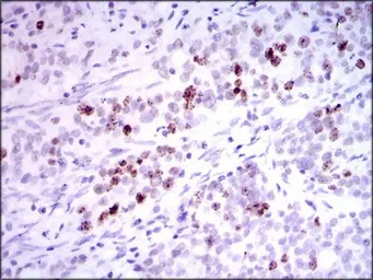 Anti-INCENP antibody [3D2] used in IHC (Paraffin sections) (IHC-P). GTX60619