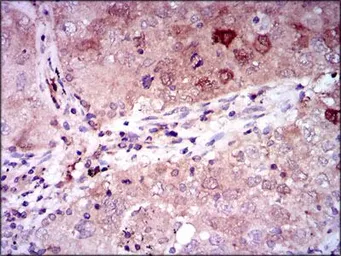 Anti-NSE antibody [5D3] used in IHC (Paraffin sections) (IHC-P). GTX60625