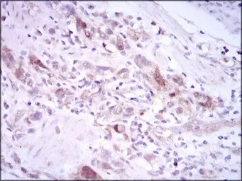 Anti-PLK1 antibody [3C11] used in IHC (Paraffin sections) (IHC-P). GTX60627