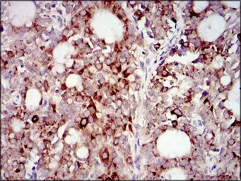 Anti-PI3 kinase p85 alpha antibody [6G10] used in IHC (Paraffin sections) (IHC-P). GTX60633