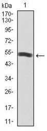 Anti-PI3 kinase p85 alpha antibody [6G10] used in Western Blot (WB). GTX60633