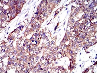 Anti-PTK9 antibody [7C11] used in IHC (Paraffin sections) (IHC-P). GTX60638