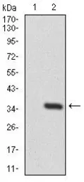 Anti-PTK9 antibody [7C11] used in Western Blot (WB). GTX60638
