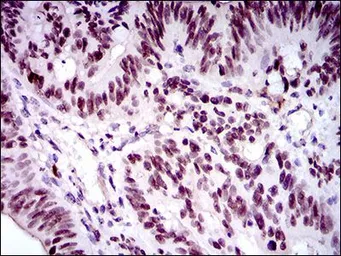 Anti-FOXP1 antibody [6E4] used in IHC (Paraffin sections) (IHC-P). GTX60643