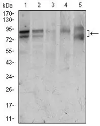 Anti-FOXP1 antibody [6E4] used in Western Blot (WB). GTX60643