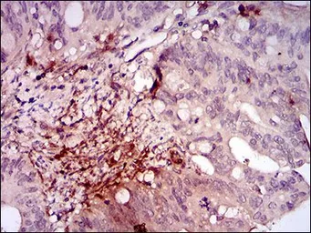 Anti-ILK antibody [3A9] used in IHC (Paraffin sections) (IHC-P). GTX60645