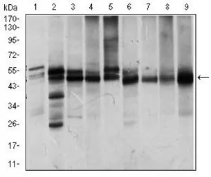 Anti-ILK antibody [3A9] used in Western Blot (WB). GTX60645