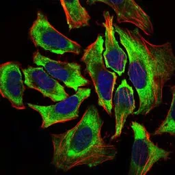 Anti-HAS2 antibody [4E7] used in Immunocytochemistry/ Immunofluorescence (ICC/IF). GTX60647
