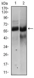Anti-HAS2 antibody [4E7] used in Western Blot (WB). GTX60647