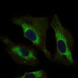 Anti-STAT5A antibody [6D4] used in Immunocytochemistry/ Immunofluorescence (ICC/IF). GTX60652