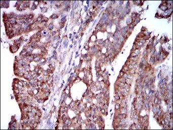 Anti-STAT5A antibody [6D4] used in IHC (Paraffin sections) (IHC-P). GTX60652